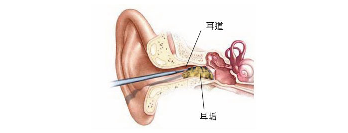 顯微鏡清洗耳道